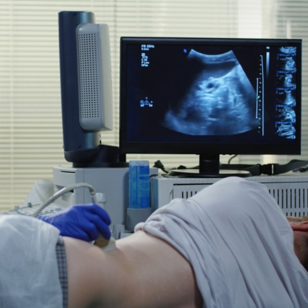 אולטרסאונד כליות, דרכי שתן וכיס השתן