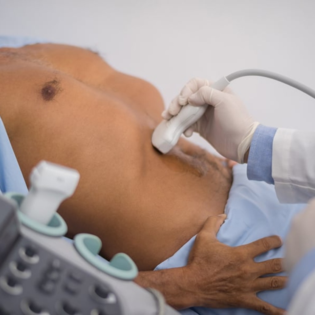 אולטרסאונד כיס מרה